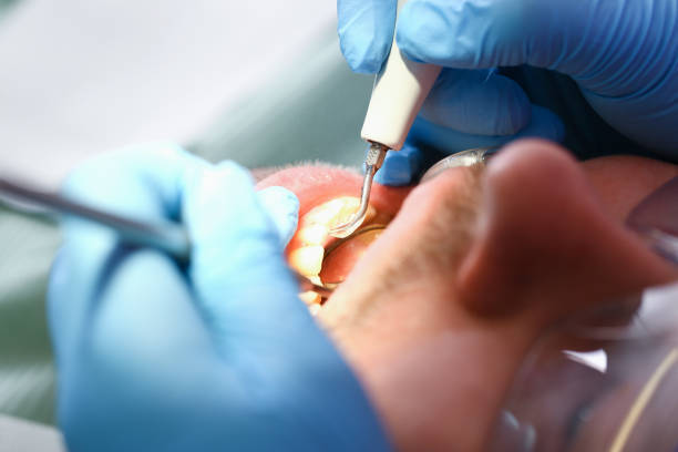 Best Emergency Root Canal Treatment in Valley Forge, TN