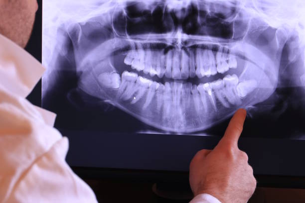 Best Emergency Denture Repair in Valley Forge, TN